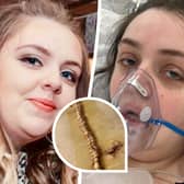 Chloe Quick was put in a medically induced coma after having surgery for a gastric sleeve in Turkey. Picture: Leah Mattson/Quick Family/SWNS