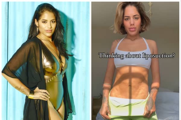 'Love Island' star Malin Andersson has opened up about how liposuction has left her with a 'lumpy tummy'. Pictured left on the dating show in 2016, and right in 2024 seven years after the procedure. Photos by ITV (left) and Instagram/missmalinsara (right).