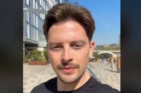 Dr Alex George, of 'Love Island' fame, is hoping to run the Hackney half marathon in May 2024, but he's had to seek hospital treatment for a knee injury which may prevent him from doing so. Photo by TikTok/DrAlexGeorge.