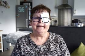 Melanie Wellings of Stonehouse, Gloucestershire, now wears a gauze over the orange-sized hole that the cancer has left in her face.