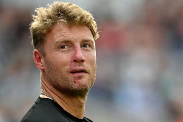 Ex-England cricketer Freddie Flintoff has revealed that the he had been left "wishing he'd died" after sustained serious facial injuries in a car crash while filming for Top Gear.