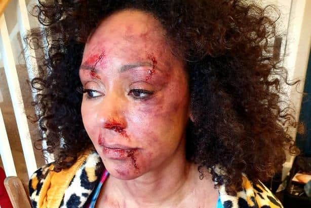 The singer was made to look bruised and bloodied for the video of her new track 'Love Should Not Hurt' (Picture: Women's aid)