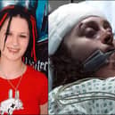 Sophie Lancaster (left) was murdered, aged 20, for how she looked. The story will now be reflected by Coronation Street actress Mollie Gallagher (right) as her character Nina is attacked (Picture: ITV)