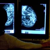 Catching breast cancer early is a key factor in successful treatment. (Picture: Rui Vieira/PA)