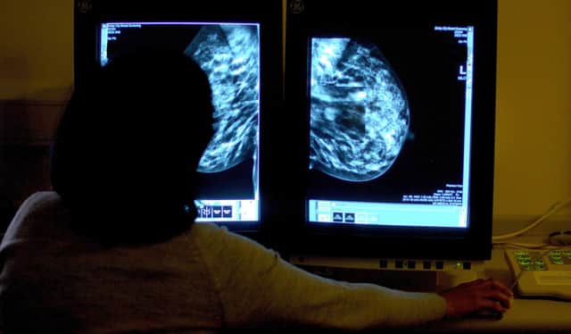 Catching breast cancer early is a key factor in successful treatment. (Picture: Rui Vieira/PA)