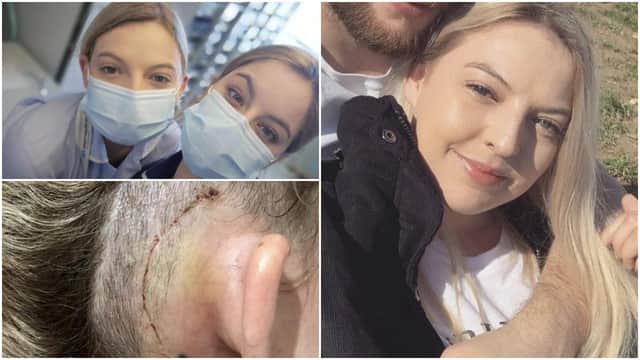 A nurse says EastEnders saved her life after her parents complained they could hear the bedroom TV through the ceiling - alerting them all to a brain tumour that was causing deafness (SWNS)