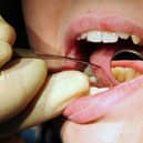 File photo dated 19/05/11 of a dentist at work. Urgent reforms are needed to "slow the decay of NHS dentistry", a think tank has warned. A report by the Nuffield Trust claims NHS dentistry is "at its most perilous point in its 75-year history"