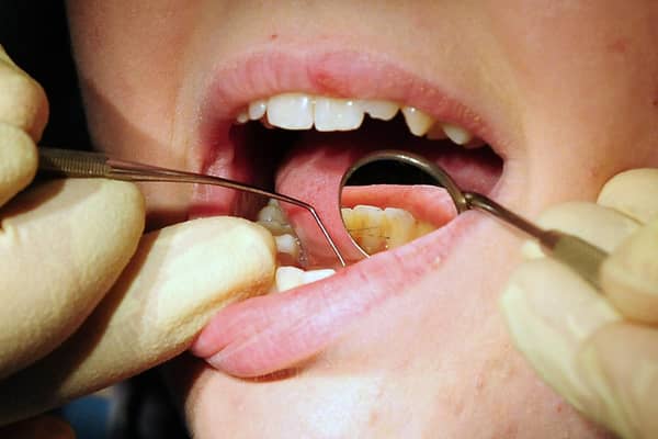File photo dated 19/05/11 of a dentist at work. Urgent reforms are needed to "slow the decay of NHS dentistry", a think tank has warned. A report by the Nuffield Trust claims NHS dentistry is "at its most perilous point in its 75-year history"