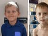 Mum's plea to check for cancer symptoms after 'devastating' diagnosis of her 8-year-old son