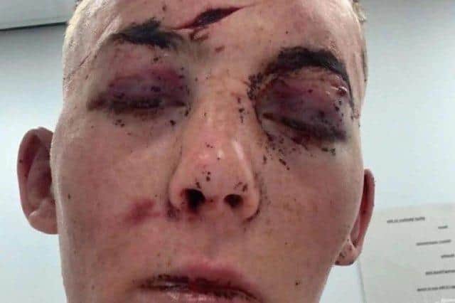 Cobhan McLelland suffered horrific injuries in the attempted murder. (Pic: GoFundMe)