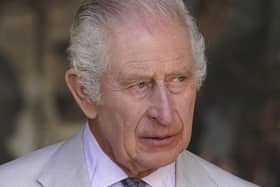 King Charles III will attend hospital next week to be treated for an enlarged prostate, Buckingham Palace said.