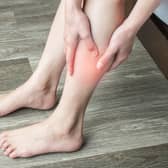 Symptoms of a blood clot include throbbing or cramping pain, swelling, redness and warmth in a leg or arm (Photo: Shutterstock)