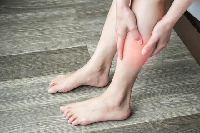 Symptoms of a blood clot include throbbing or cramping pain, swelling, redness and warmth in a leg or arm (Photo: Shutterstock)