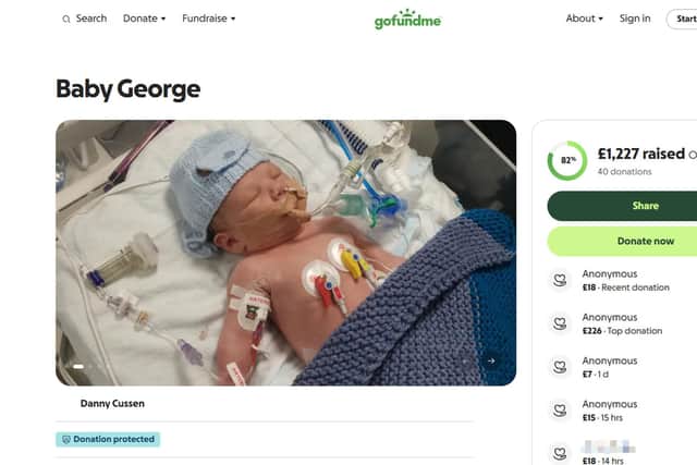 A couple's baby joy turned to horror when they discovered their newborn son needed a life-saving op to be 'REPLUMBED' - as he had a back-to-front heart.