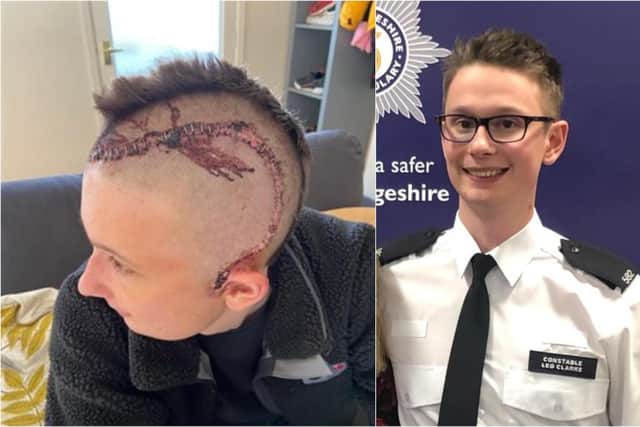 PC Leo Clarke suffered a potentially deadly bleed on the brain after he was assaulted (Photo: SWNS)
