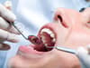 Rise in mouth cancer deaths linked to shortage of NHS dentists