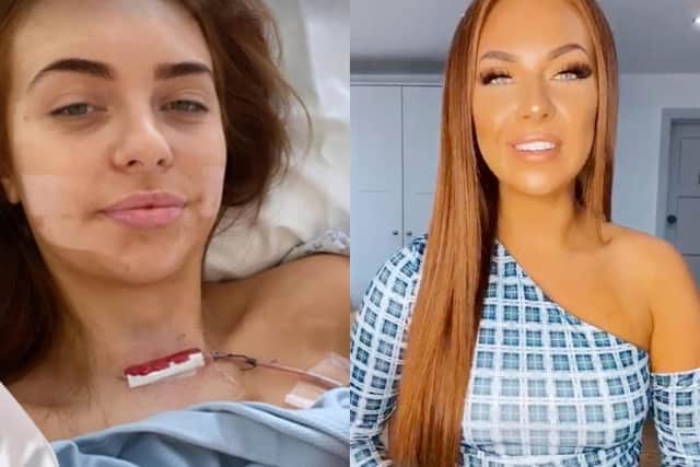 Reality star Demi Jones told Instagram followers that she had been diagnosed with thyroid cancer (Getty Images/Instagram)