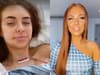 Love Island star Demi Jones, 22, diagnosed with thyroid cancer - symptoms of the disease to look for