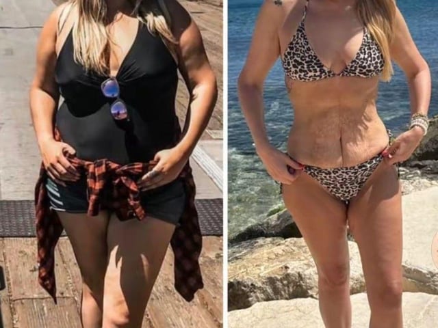 Raquel Sardinha before weight loss and before skin removal (Cover Media)