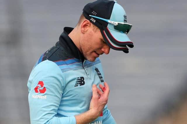 England captain Eoin Morgan is a doubt after splitting the webbing in his hand.