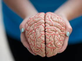 Parkinson's disease is a neurodegenerative disorder which impacts parts of the brain (Getty Images)