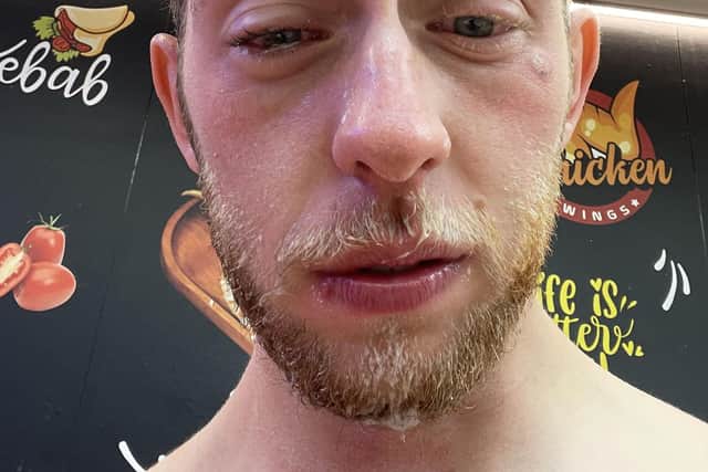 Wellingborough holidaymaker films getting pepper sprayed by bouncer