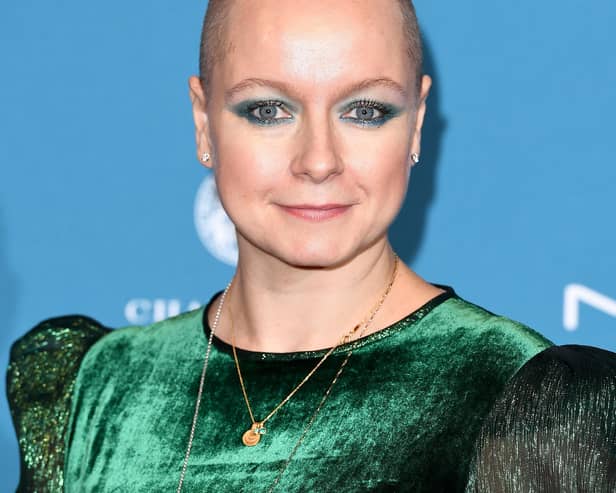 Samantha Morton will be the latest member of the BAFTA Fellowship as she receives the award at this years' ceremony in London (Credit: Getty)