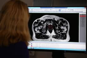 A consultant clinical oncologist examines a scan showing inside the body